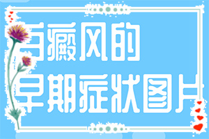 嬰兒手上有白斑是缺乏維生素嗎,常見(jiàn)原因(病情加重是因?yàn)槭裁?