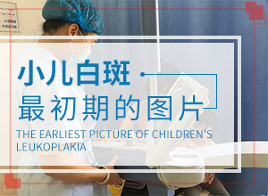 孩子背后長白斑怎么辦,不同時(shí)期的病發(fā)表現(xiàn)是怎樣的(要做什么檢查)