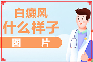 白班有幾種圖片,前期癥狀怎樣(一般長(zhǎng)在什么部位呢)