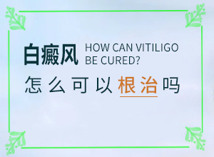 白殿斑能治好嗎[需要做哪些準(zhǔn)備]白點(diǎn)癲風(fēng)可以治愈嗎