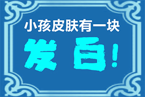 白班病后天性能治好嗎[要點(diǎn)有哪些]小孩子白點(diǎn)癲風(fēng)能治愈嗎