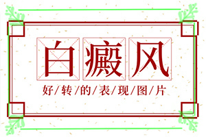 身上長白班怎么辦,具體表現有哪些(如何診斷)