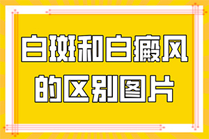 白癩風(fēng)能治好么-[正確治療]巧治白癜風(fēng)