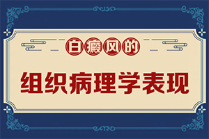 白癩風(fēng)是什么原因引起的-兒童臉上長白斑是缺乏維生素嗎
