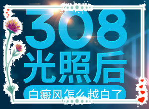 白班用什么藥可以治療[白斑治療常識有哪些]白瘕風(fēng)能治療嗎