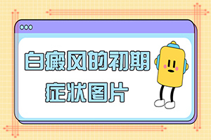腳小腿長白斑是什么原因[都有哪些表現(xiàn)]白癲風(fēng)早期圖片