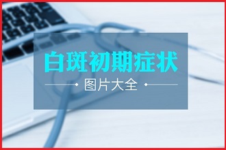 白點風患者如何進行科學有效的醫(yī)治