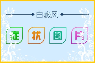 甕安縣白點風患者頸部患病注意哪些!
