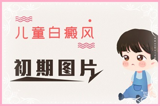青少年白癩風(fēng)頻發(fā)，這些原因你都了解嗎