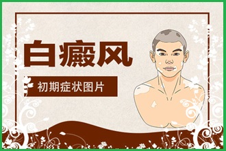 白癩風(fēng)遮蓋液去哪家買(mǎi)好，什么牌子的比較好用呢