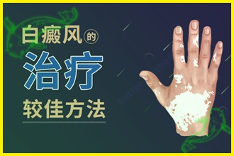 白顛風(fēng)怎么治療好的快-檢查病因、制定方法、防護(hù)三步走