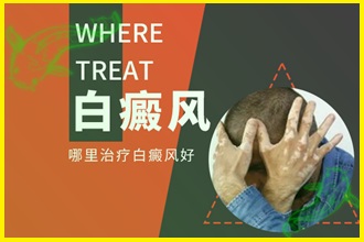 白癲風的早期癥狀圖片避免擴散，這些措施要一一執(zhí)行