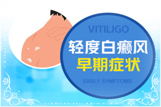 白顛瘋病初期癥狀醫(yī)治費用是多少-哪些因素影響費用