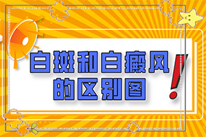 白殿風(fēng)初期是什么癥狀,癥狀如何診斷(癥狀有哪些不同)