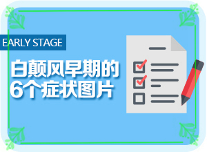小兒臉上長的有白斑是什么情況,是怎么出現(xiàn)的(產(chǎn)生什么影響)
