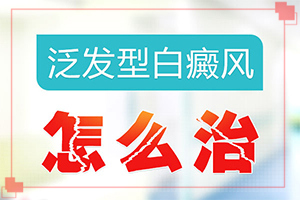 白癲風(fēng)用什么藥好[應(yīng)該如何]白癲瘋手上能嗎