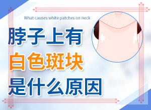 臉上白斑是什么原因，如何解決,什么原因會誘導(dǎo)白斑(常見原因)