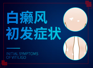 治療白癲瘋醫(yī)院,如何比較好的治療(如何比較好的治療)