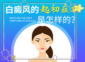 白癲瘋可以治得了嗎[治療中斷會有什么影響]遺傳白巔峰治療法