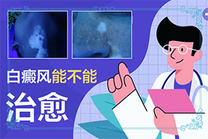 兒童白顛風(fēng)早期癥狀,好發(fā)部位有哪些(持續(xù)發(fā)展會怎么樣)