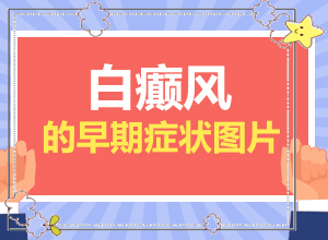 白癜風(fēng)常見誘因有哪些-脖子上長一塊白斑是什么引起的