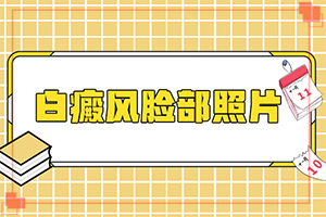 小寶寶脖子上有白斑點(diǎn)是什么原因，怎么治療（為何不易治）