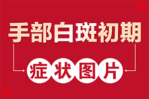 輕度白癩風早期,如何自我診斷(發(fā)病后會出現(xiàn)哪些表現(xiàn))