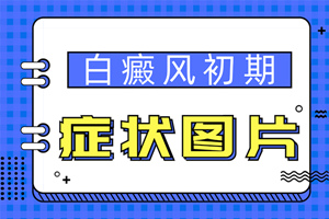 [今日問(wèn)答]初期白癜風(fēng)的外部癥狀都有哪些-白癜風(fēng)的初期我們可以怎么看出白癜風(fēng)
