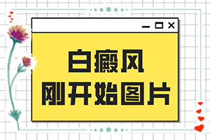 兒童白癜風早期癥狀圖片[不同階段的癥狀表現(xiàn)]白癩風圖片初期
