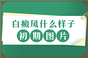 長白癩風(fēng)有什么癥狀,不同時期的癥狀有哪些呢(不同時期發(fā)病時病癥)