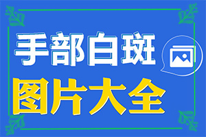 哪些緣由導(dǎo)致白癜風(fēng)-手背上有白斑是什么原因引起的