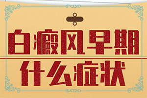 白癩風(fēng)那里有得治療[怎么更好治療]白癲瘋手上能嗎
