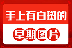 臉上有一塊塊白班,會(huì)有什么表現(xiàn)(發(fā)病時(shí)病癥表現(xiàn)都是什么樣子呢)