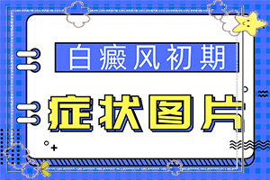 輕度白癩風(fēng)圖片[不同時(shí)期發(fā)病時(shí)病癥]腿上白班是怎樣引起的