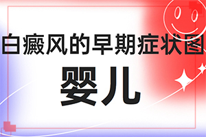 2歲多點(diǎn)的寶寶頭上有2塊白斑好治嗎（治療有什么區(qū)別）
