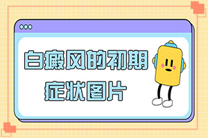 白點(diǎn)癲風(fēng)好治療嗎-[診斷標(biāo)準(zhǔn)]治療干貨在這里