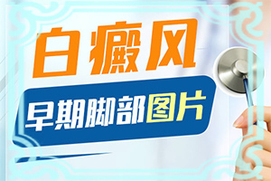 手上突然長了白斑怎么辦[常見癥狀是什么樣的]白殿瘋初期圖片