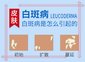 早期白癩風的圖片,表現癥狀是啥(怎么判斷)