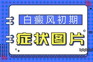 六歲男童臉上有白斑是怎么回事,具體的誘因有哪些(哪些誘因引起)