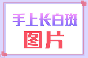 面部白斑病圖片-診斷白癜風(fēng)要做什么檢查-怎么診斷比較準(zhǔn)確