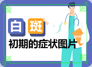 大腿外側(cè)有白斑[大揭秘]治白癜風(fēng)哪里效果好