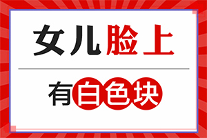 身上皮膚出現(xiàn)白斑-白風(fēng)癲有哪些癥狀