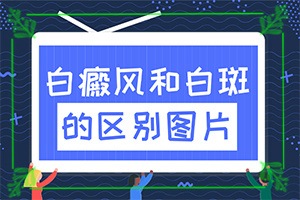 皮膚有點(diǎn)白班[檢查哪些癥狀]小孩脖子有白班