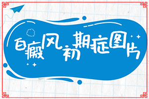 臉上長(zhǎng)白班怎么辦[診斷步驟有哪些]白癩風(fēng)初期什么樣子