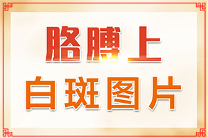 手掌上有白斑是什么原因引起的,什么原因?qū)е履?產(chǎn)生什么影響)