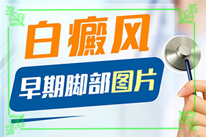 身上越來越白怎么回事-藥物治療效果