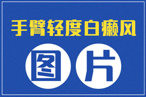[白斑課堂]手臂上膚色不均勻出現(xiàn)小白斑是什么情況-早期手臂白癜風圖片