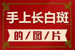 皮膚為什么會出現(xiàn)白斑,癥狀看起來都是啥樣子的(不同類型的癥狀有哪些表現(xiàn)呢)