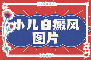 白癩風可以治療好嗎？有什么土方法嗎（診療白斑這些是關鍵）