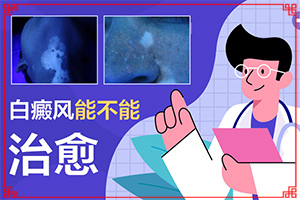 小女孩的臉上有白斑是怎么回事,發(fā)病的因素有哪些(因素有哪些呢)